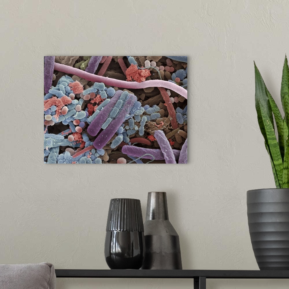 A modern room featuring Tongue bacteria. Coloured scanning electron micrograph (SEM) of bacteria on the surface of a huma...
