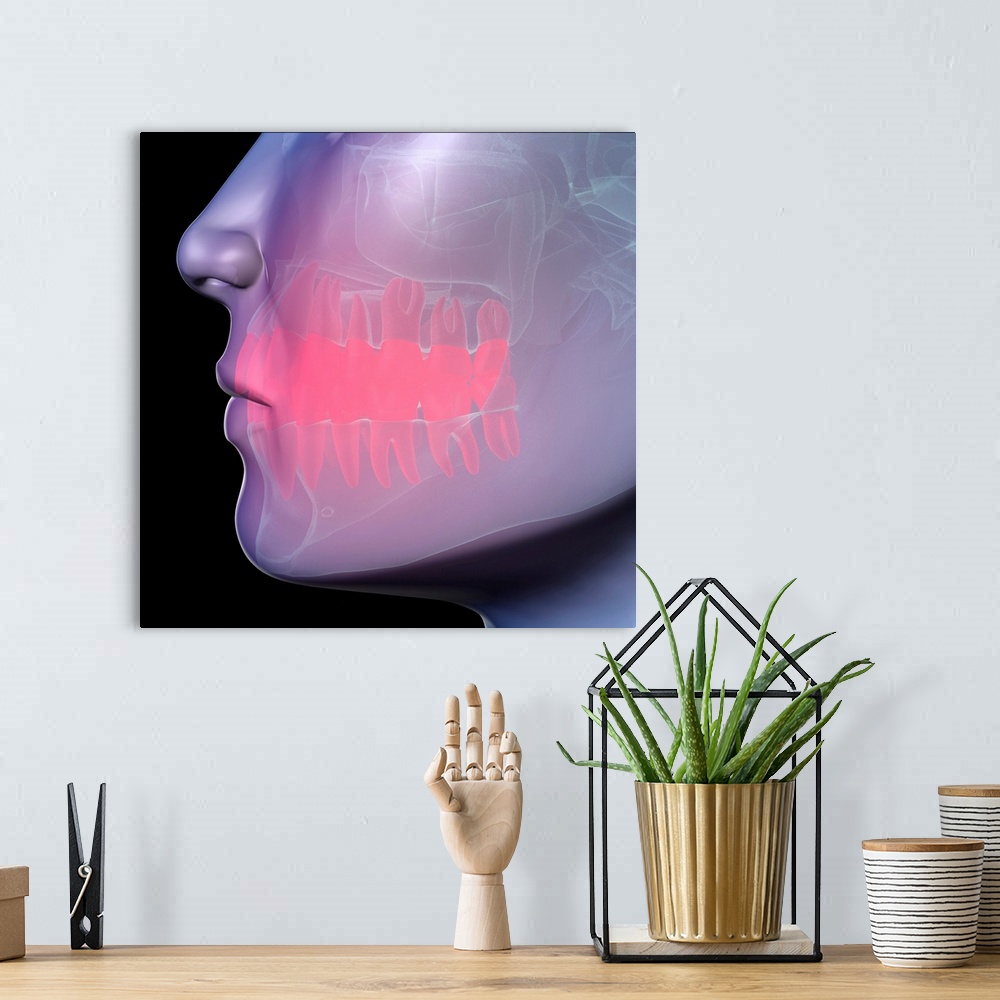 A bohemian room featuring Toothache. Conceptual computer artwork showing pain (represented as the red area) in the teeth. T...