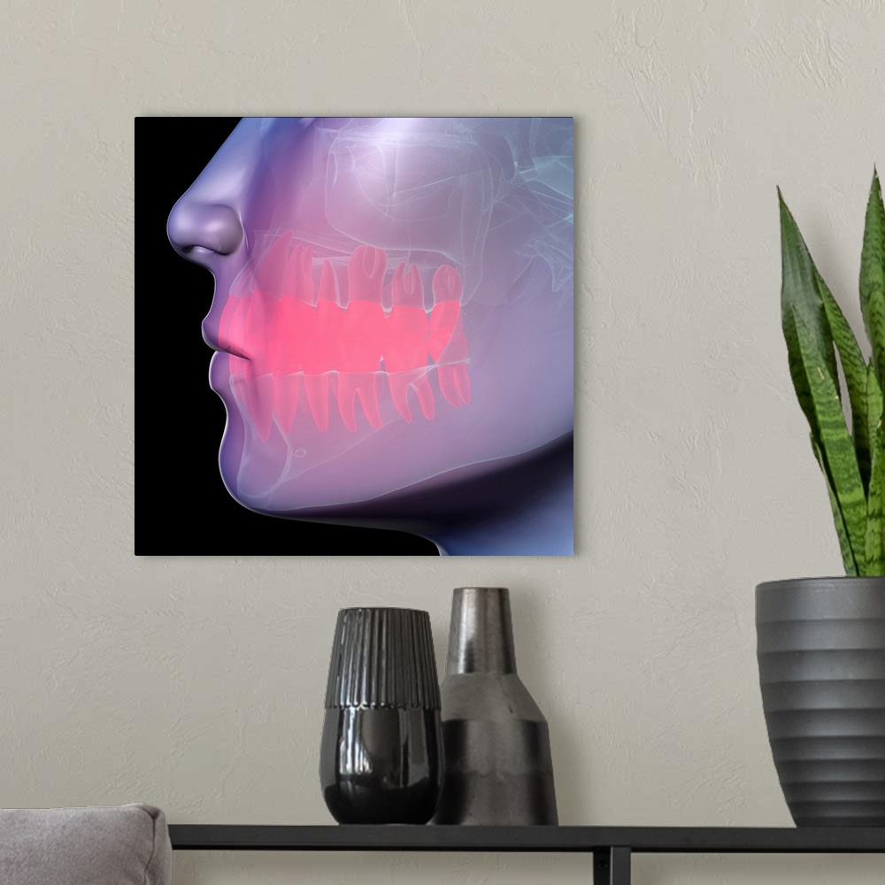 A modern room featuring Toothache. Conceptual computer artwork showing pain (represented as the red area) in the teeth. T...