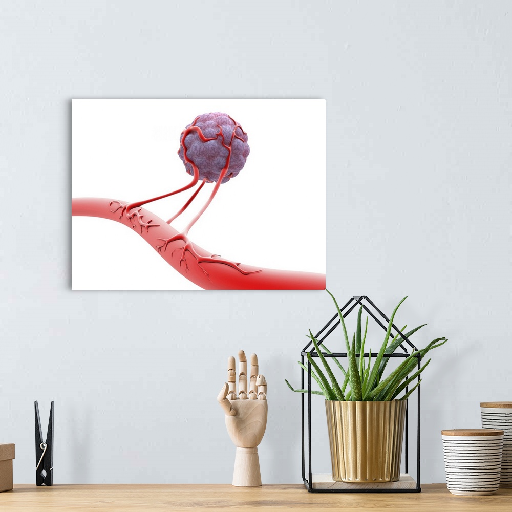 A bohemian room featuring Blood vessel formation. Artwork showing malignant (cancerous) tumour cells promoting the formatio...
