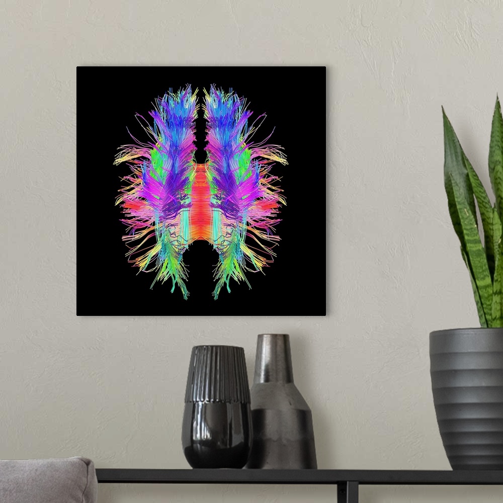 A modern room featuring White matter fibres overlaid a 3d model of the human brain in top view. Coloured 3D diffusion spe...