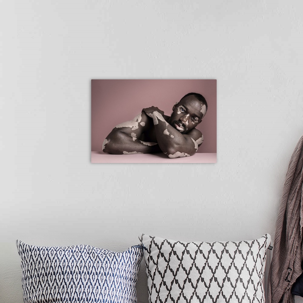 A bohemian room featuring Fashion Portrait Of Black Man With Vitiligo