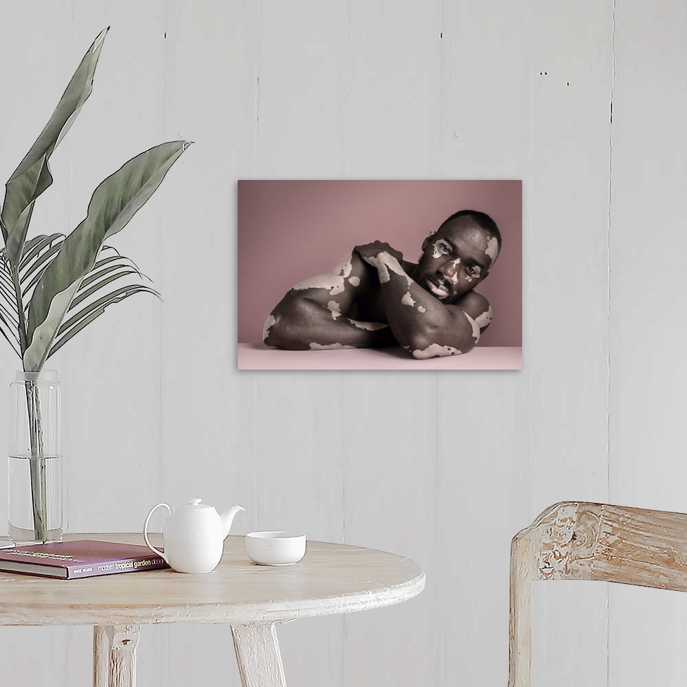 A farmhouse room featuring Fashion Portrait Of Black Man With Vitiligo