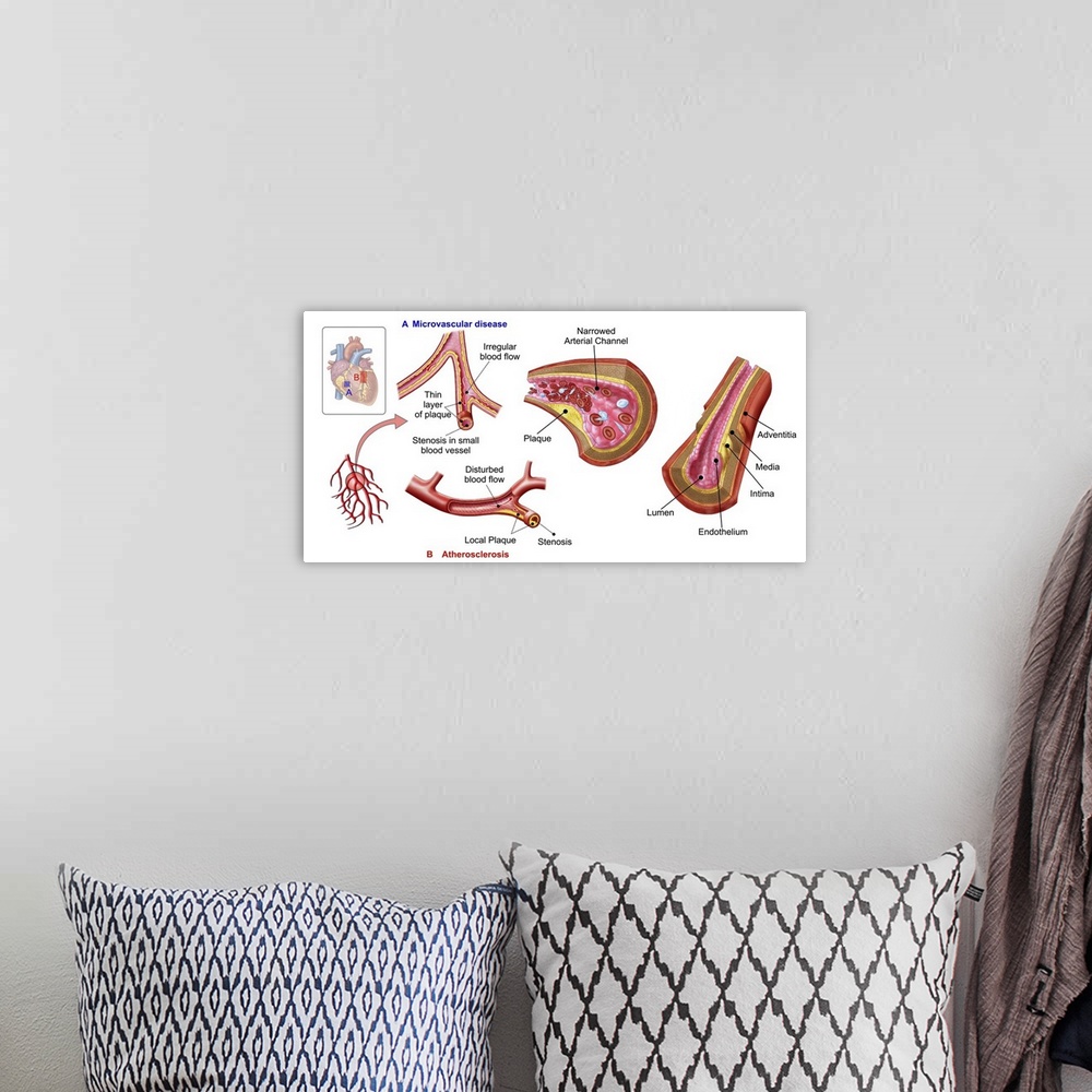 A bohemian room featuring Blood vessel anatomy.