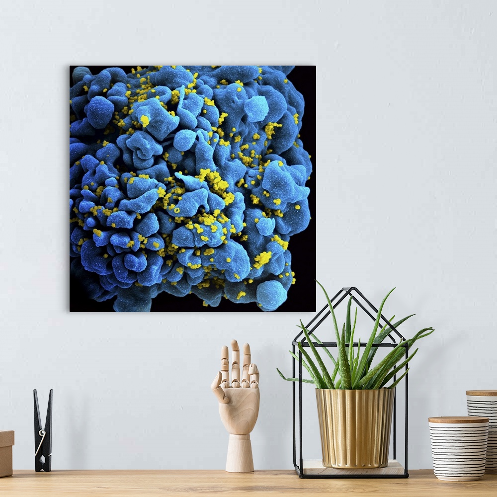 A bohemian room featuring Colorized image of HIV-infected H9 T-cell.