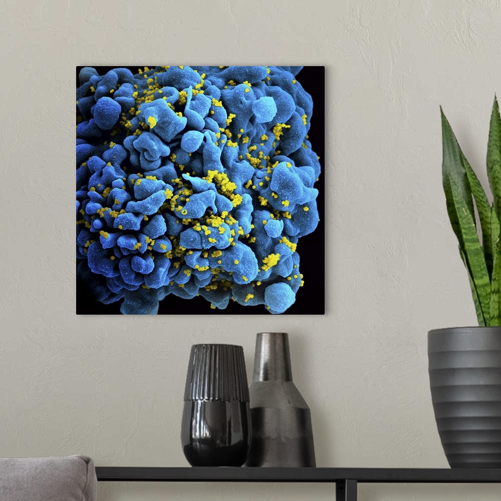 A modern room featuring Colorized image of HIV-infected H9 T-cell.