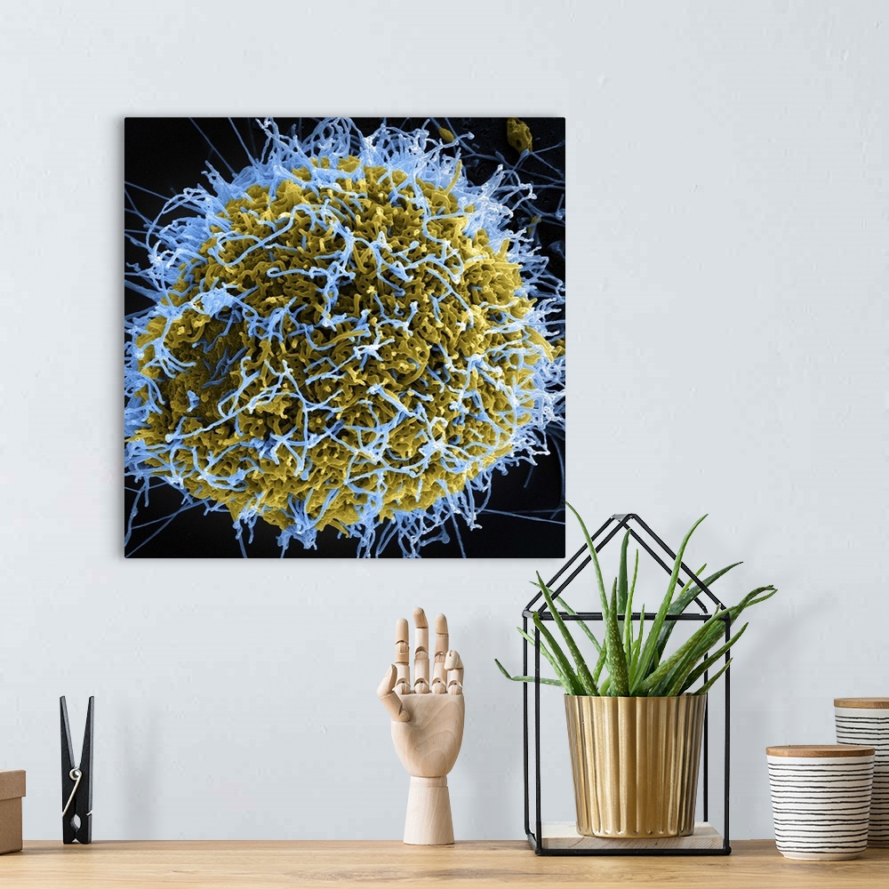 A bohemian room featuring Colorized scanning electron micrograph of filamentous Ebola virus particles (blue) budding from a...