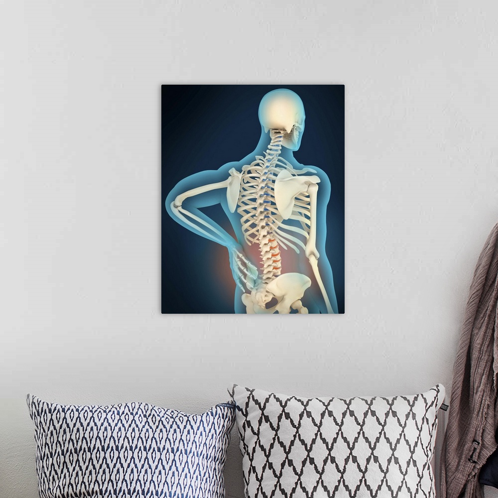 A bohemian room featuring Medical illustration showing inflammation and pain in human back area, perspective view.