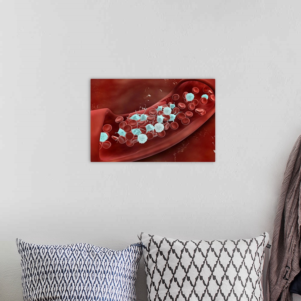 A bohemian room featuring Microscopic view of blood clotting inside the artery.