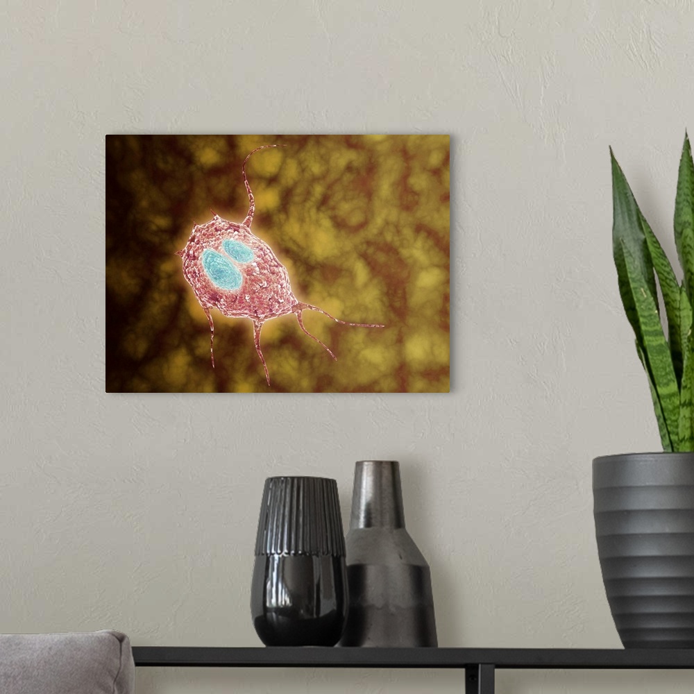 A modern room featuring Microscopic view of Giardiasis, an infectious disease caused by a unicellular parasite known as G...