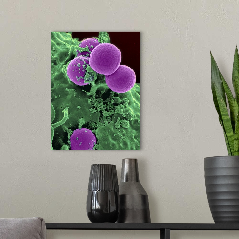 A modern room featuring Scanning electron micrograph of a human neutrophil ingesting MRSA.