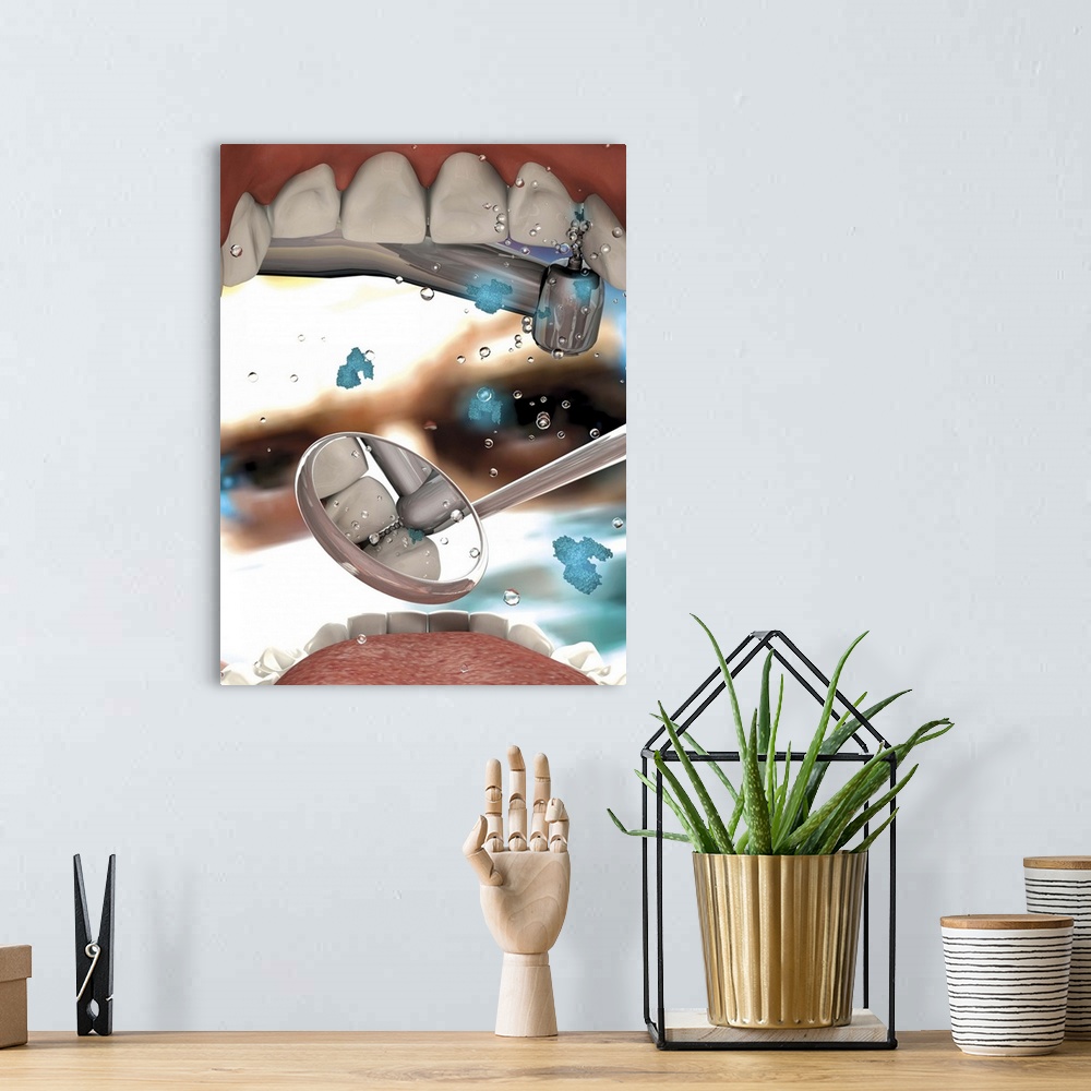 A bohemian room featuring View looking from inside the mouth while at the dentist.